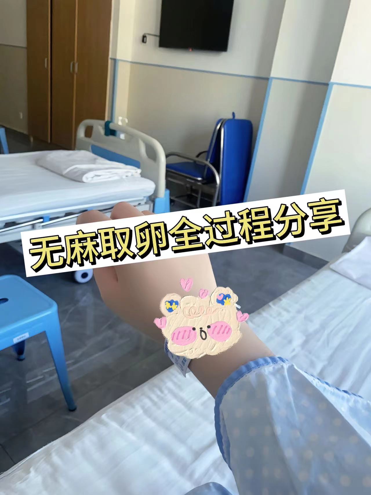 无麻取卵没有很痛，主要是会紧张